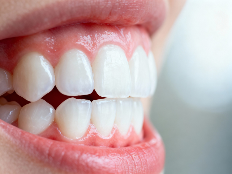 Healthy Gum & Smile